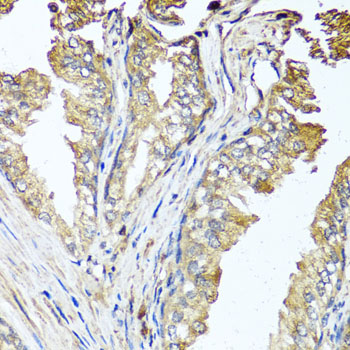 Immunohistochemistry - STK3 Polyclonal Antibody 