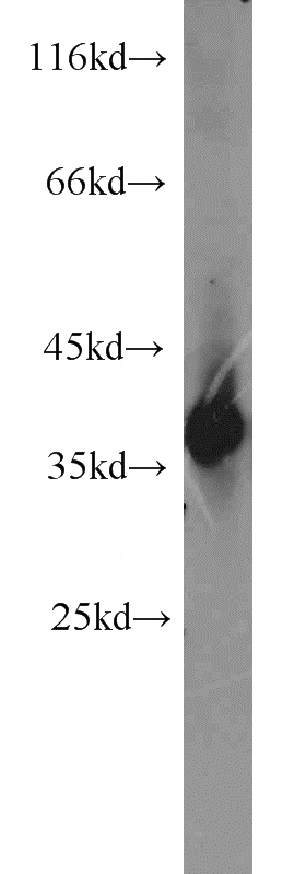 mouse brain tissue were subjected to SDS PAGE followed by western blot with Catalog No:112947(NAPB antibody) at dilution of 1:1200
