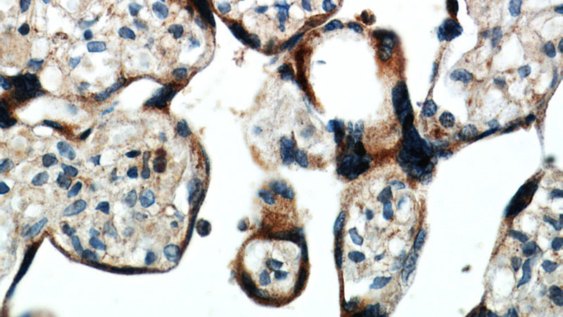 Immunohistochemical of paraffin-embedded human placenta using Catalog No:107672(AAMP antibody) at dilution of 1:100 (under 40x lens)
