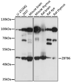 Western blot - ZBTB6 Polyclonal Antibody 