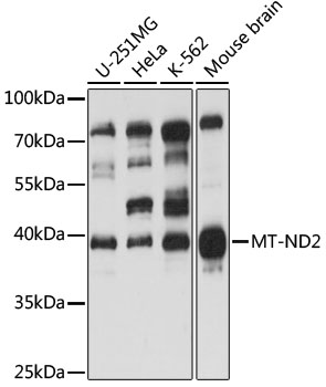 Western blot - MT-ND2 Polyclonal Antibody 