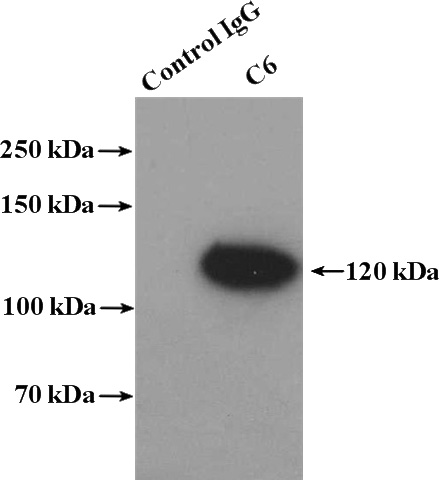 IP Result of anti-C6 (IP:Catalog No:108739, 4ug; Detection:Catalog No:108739 1:800) with human plasma tissue lysate 4000ug.