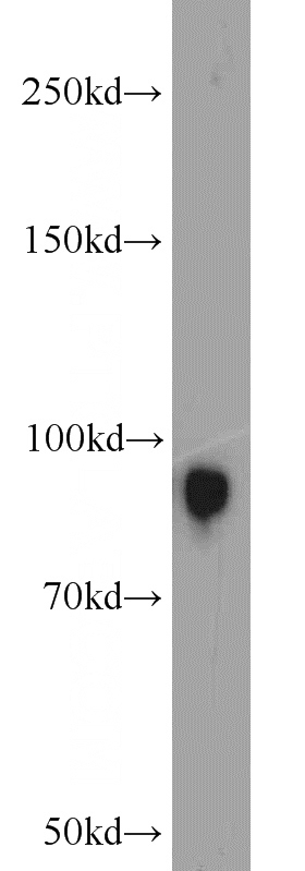 mouse kidney tissue were subjected to SDS PAGE followed by western blot with Catalog No:116752(VIL1 antibody) at dilution of 1:2000
