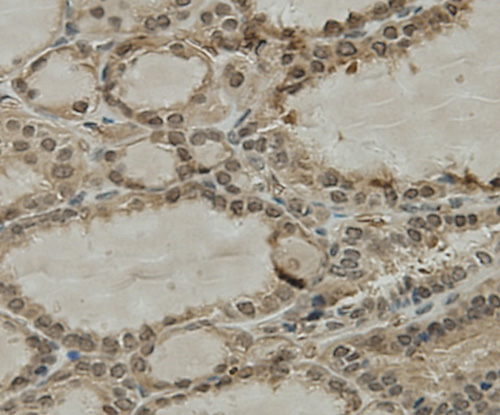 Fig6: Immunohistochemical analysis of paraffin-embedded human thyroid tissue using anti-CCDC51 antibody. Counter stained with hematoxylin.