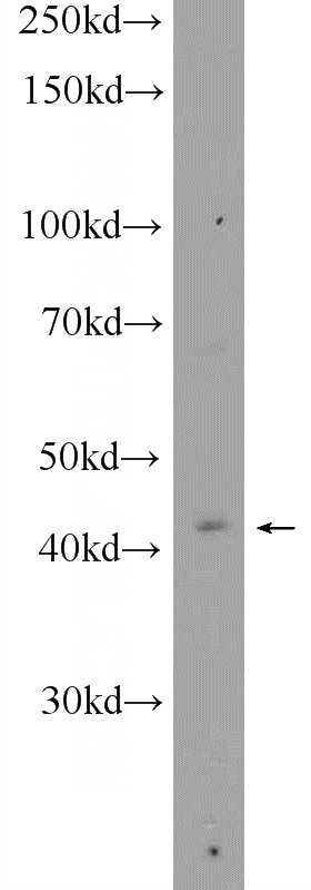 MCF-7 cells were subjected to SDS PAGE followed by western blot with Catalog No:109782(CYTB Antibody) at dilution of 1:300