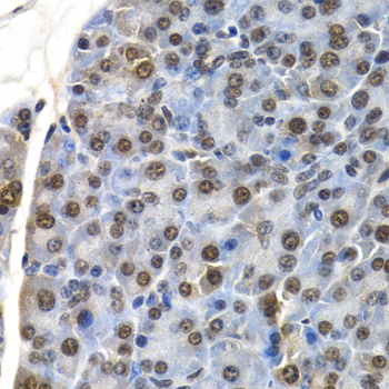 Immunohistochemistry - ID3 Polyclonal Antibody 