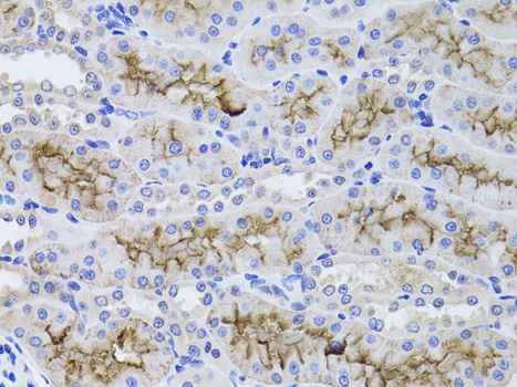 Immunohistochemistry - GGT1 Polyclonal Antibody 