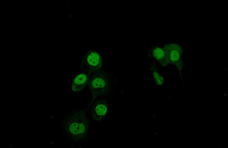 Immunofluorescent analysis of A431 cells using Catalog No:115043(SAFB Antibody) at dilution of 1:50 and Alexa Fluor 488-congugated AffiniPure Goat Anti-Rabbit IgG(H+L)
