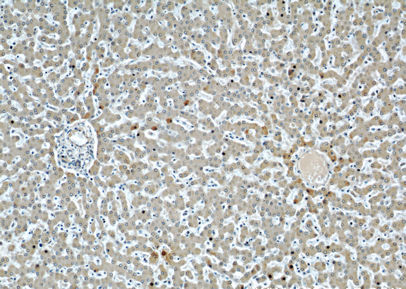 Immunohistochemical of paraffin-embedded human liver using Catalog No:107066(APOH antibody) at dilution of 1:50 (under 10x lens)