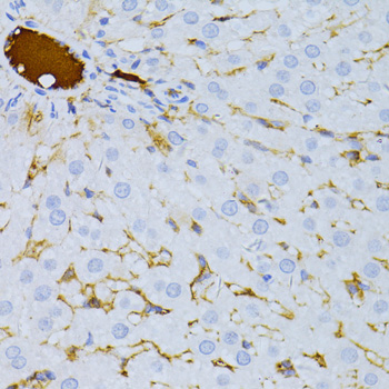 Immunohistochemistry - TAPBP Polyclonal Antibody 
