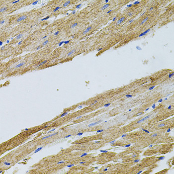 Immunohistochemistry - TRMT2A Polyclonal Antibody 