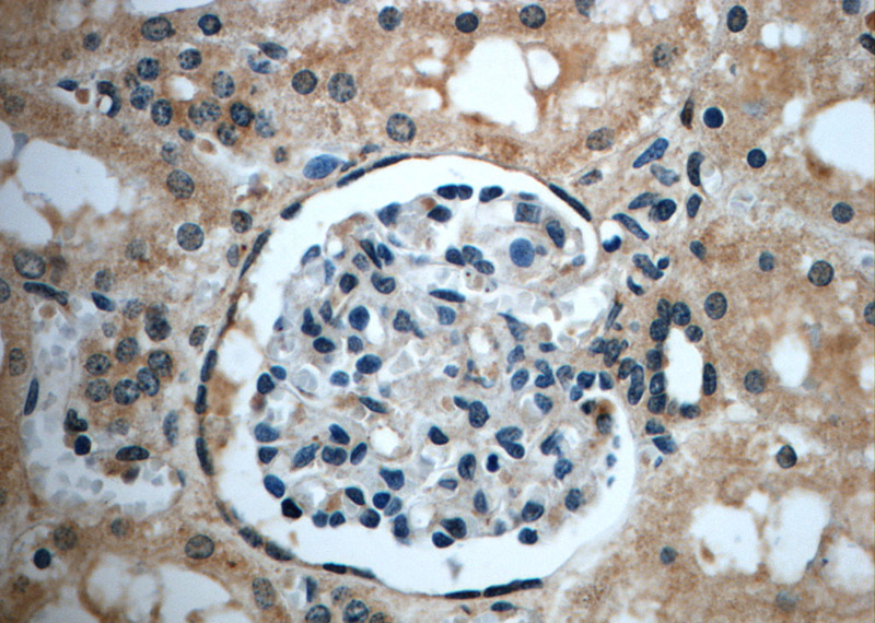 Immunohistochemistry of paraffin-embedded human kidney slide using Catalog No:116930(ZC3HAV1L Antibody) at dilution of 1:50