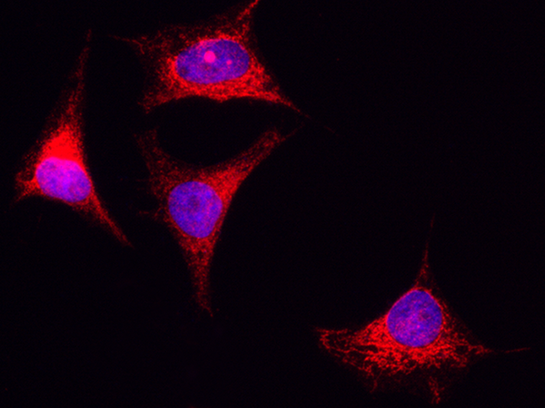 PIK3CA Antibody, Rabbit PAb, Antigen Affinity Purified, Immunofluorescence