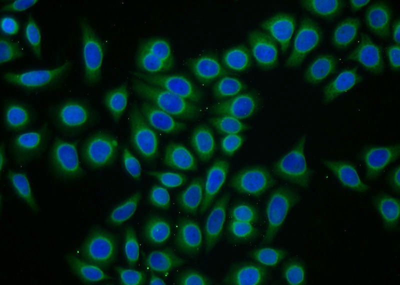 Immunofluorescent analysis of PC-3 cells using Catalog No:109508(PPP1R14A Antibody) at dilution of 1:25 and Alexa Fluor 488-congugated AffiniPure Goat Anti-Rabbit IgG(H+L)