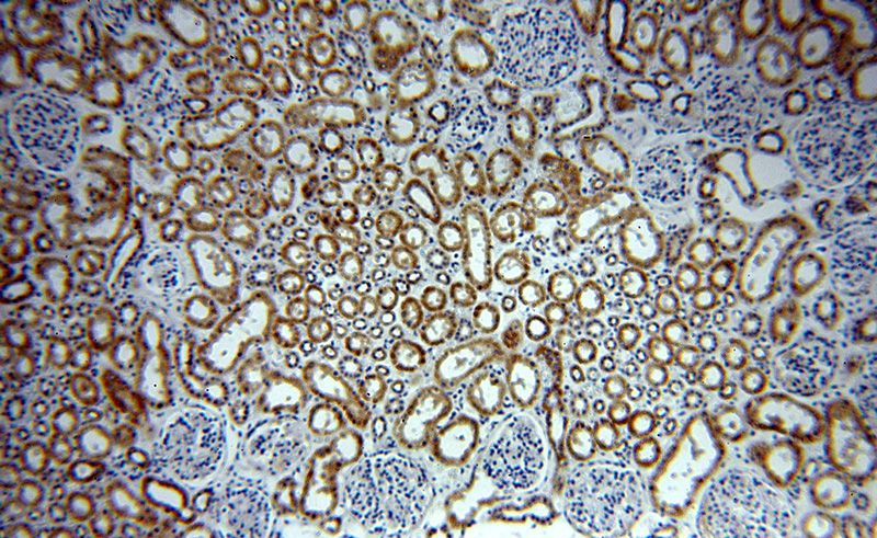 Immunohistochemical of paraffin-embedded human kidney using Catalog No:113080(NDUFC2 antibody) at dilution of 1:400 (under 10x lens)