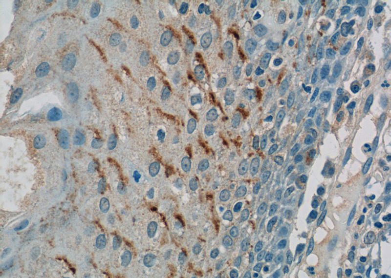 Immunohistochemistry of paraffin-embedded human tonsillitis tissue slide using Catalog No:111167(GSG1L Antibody) at dilution of 1:50 (under 40x lens)
