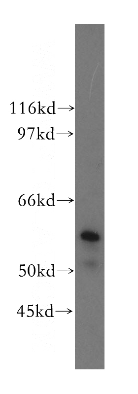 human liver tissue were subjected to SDS PAGE followed by western blot with Catalog No:113466(ocLN antibody) at dilution of 1:600
