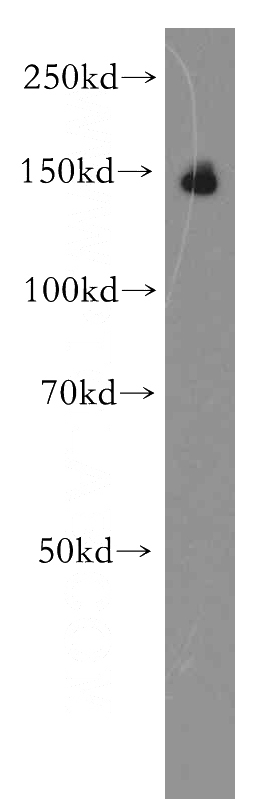 human brain tissue were subjected to SDS PAGE followed by western blot with Catalog No:117233(BCAN antibody) at dilution of 1:500