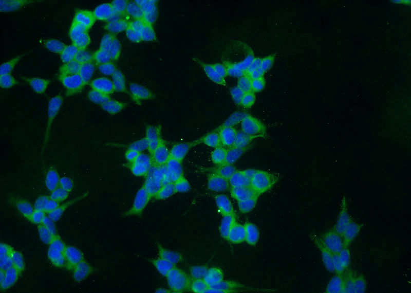 Immunofluorescent analysis of HEK-293 cells using Catalog No:109397(CLN6 Antibody) at dilution of 1:25 and Alexa Fluor 488-congugated AffiniPure Goat Anti-Rabbit IgG(H+L)