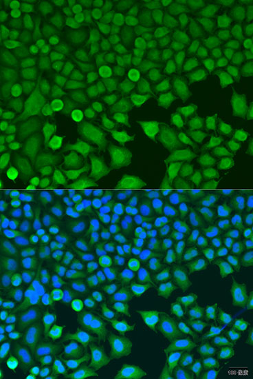 Immunofluorescence - BCKDK Polyclonal Antibody 