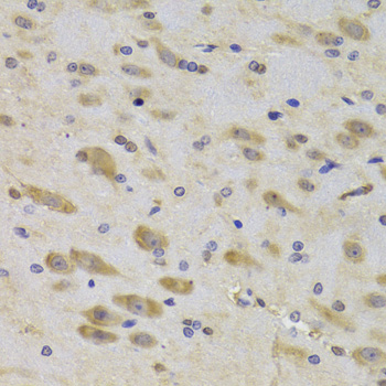 Immunohistochemistry - RPS27 Polyclonal Antibody 