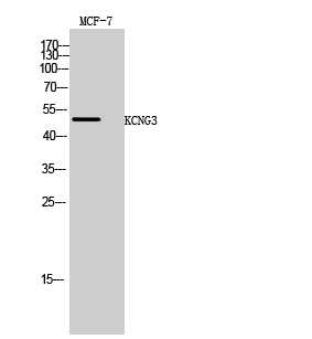 Fig1:; Western Blot analysis of MCF-7 cells using KCNG3 Polyclonal Antibody