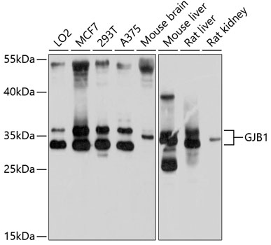 Western blot - GJB1 Polyclonal Antibody 
