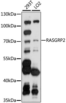 Western blot - RASGRP2 Polyclonal Antibody 
