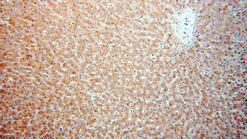 Immunohistochemical of paraffin-embedded human liver using Catalog No:114262(PTCH1 antibody) at dilution of 1:50 (under 10x lens)