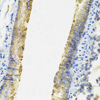 Immunohistochemistry - ACSS2 Polyclonal Antibody 