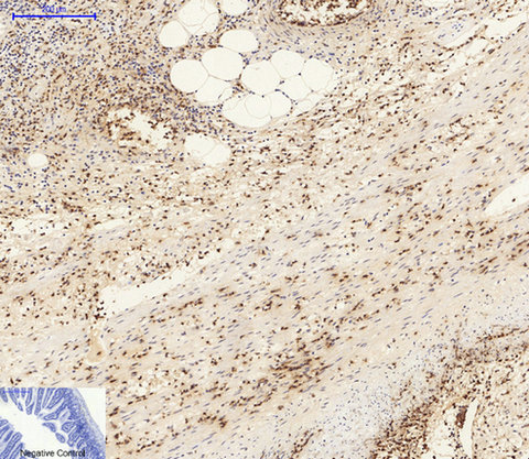 Immunohistochemical analysis of paraffin-embedded Mouse-colon tissue. 1,AMPKα1/2 Polyclonal Antibody was diluted at 1:200(4°C,overnight). 2, Sodium citrate pH 6.0 was used for antibody retrieval(>98°C,20min). 3,Secondary antibody was diluted at 1:200(room tempeRature, 30min). Negative control was used by secondary antibody only.