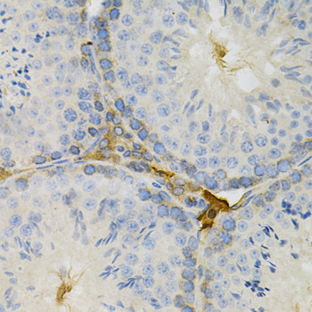 Immunohistochemistry - TAPBP Polyclonal Antibody 