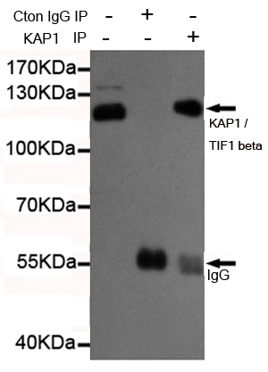 Immunoprecipitation analysis of Hela cell lysates using KAP1 / TIF1 beta mouse mAb.