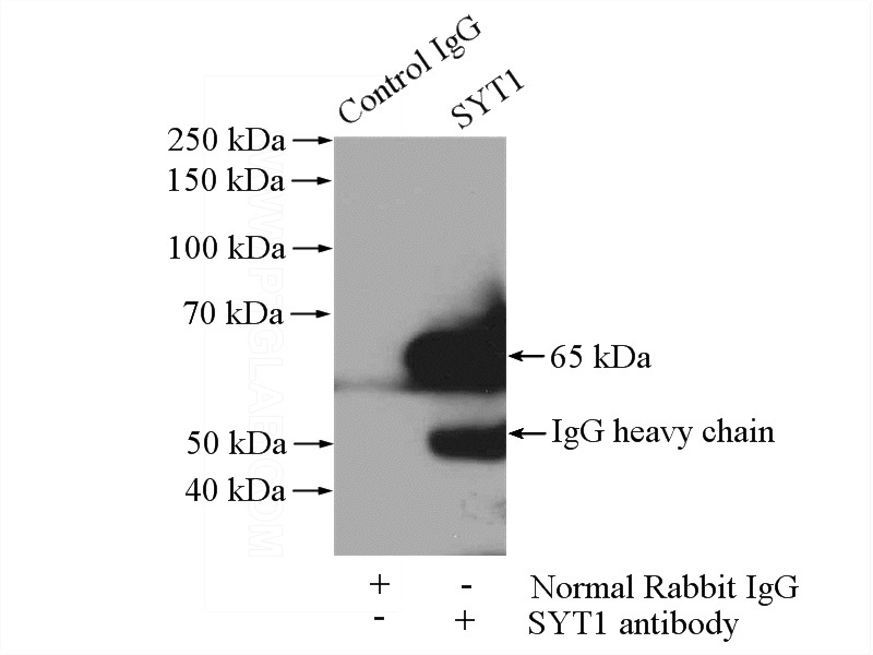 IP Result of anti-SYT1 (IP:Catalog No:115771, 4ug; Detection:Catalog No:115771 1:500) with mouse testis tissue lysate 4000ug.