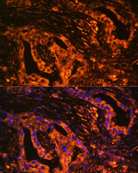 Immunofluorescence - SCNN1A Polyclonal Antibody 