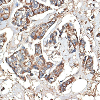 Immunohistochemistry - KRT81 Polyclonal Antibody 