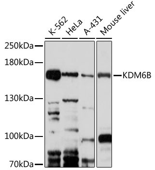 Western blot - Kdm6b Polyclonal Antibody 