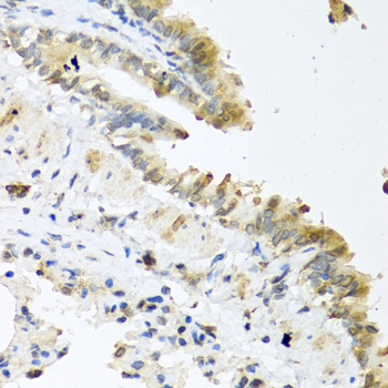 Immunohistochemistry - Wnt5a Polyclonal Antibody 