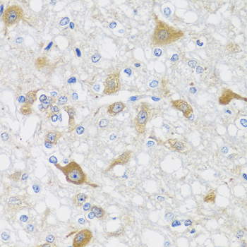 Immunohistochemistry - CRTAP Polyclonal Antibody 