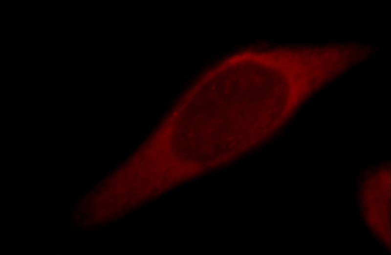 Immunofluorescent analysis of MCF-7 cells, using PIBF1 antibody Catalog No:113885 at 1:25 dilution and Rhodamine-labeled goat anti-rabbit IgG (red).