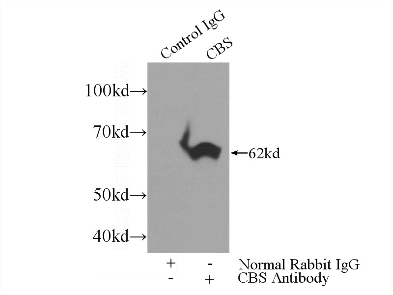 IP Result of anti-CBS (IP:Catalog No:108942, 3ug; Detection:Catalog No:108942 1:500) with mouse kidney tissue lysate 4000ug.