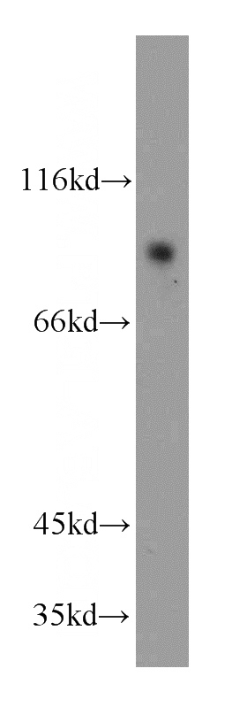 human brain tissue were subjected to SDS PAGE followed by western blot with Catalog No:111142(GPRIN3-Specific antibody) at dilution of 1:300