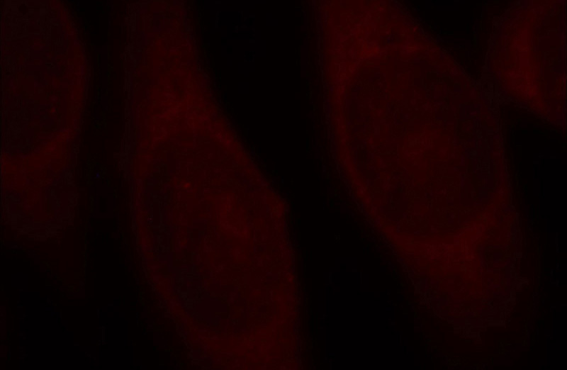 Immunofluorescent analysis of Hela cells, using PRKCD antibody Catalog No:113849 at 1:25 dilution and Rhodamine-labeled goat anti-rabbit IgG (red).