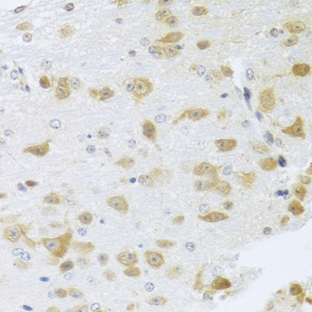 Immunohistochemistry - Gm13125 Polyclonal Antibody 