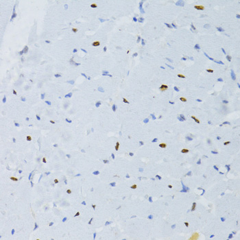 Immunohistochemistry - SNRNP70 Polyclonal Antibody 