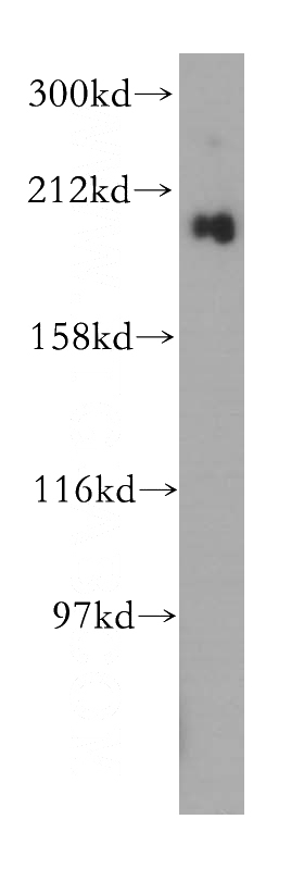 mouse lung tissue were subjected to SDS PAGE followed by western blot with Catalog No:111053(NUP210 antibody) at dilution of 1:300