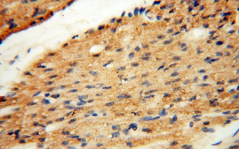 Immunohistochemical of paraffin-embedded human heart using Catalog No:107367(KMO antibody) at dilution of 1:50 (under 40x lens)