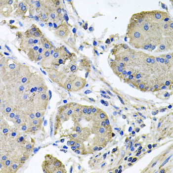 Immunohistochemistry - NDUFA6 Polyclonal Antibody 