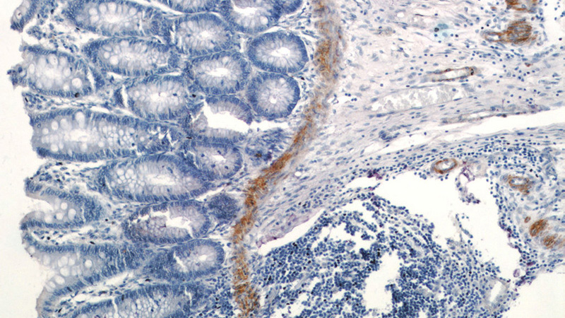 Immunohistochemistry of paraffin-embedded human colon tissue slide using Catalog No:107640(TAGLN Antibody) at dilution of 1:200 (under 10x lens)