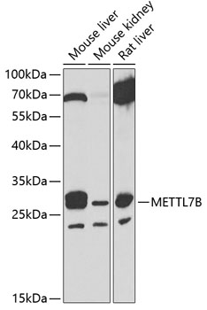 Western blot - METTL7B Polyclonal Antibody 